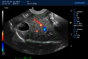 S80高端便攜獸用彩超-彩色多普勒多普勒超聲診斷儀掃描圖