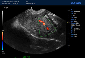 S90動(dòng)物寵物B超儀檢測(cè)圖