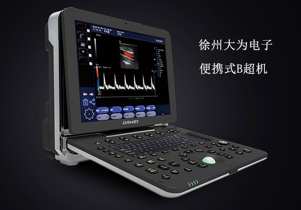 腹部B超機與陰道B超機區(qū)別 便攜式B超機圖