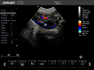 S9獸用彩超機(jī)檢查圖