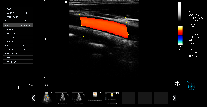 P5-VET便攜獸用彩超機(jī)頸動(dòng)脈檢查圖